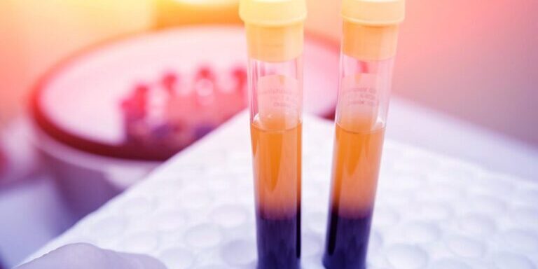 Effective Chiropractic Relief for Accident Bruising